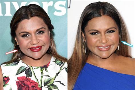 mindy kaling plastic surgery|Mindy Kaling’s plastic surgery – questionable complexion ...